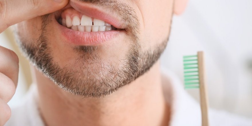 Gingivitis Nedir?